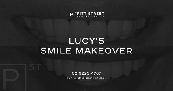 Lucy’s Smile Makeover Journey in Double Bay