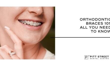 Orthodontic Braces 101: All You Need to Know