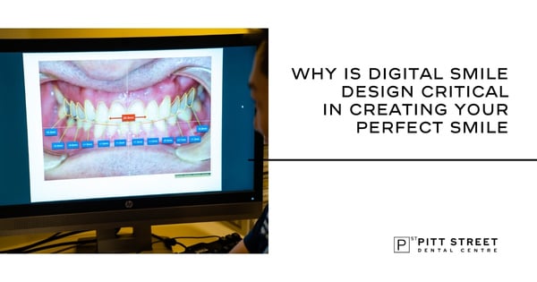 Why Is Digital Smile Design Critical in Creating Your Perfect Smile