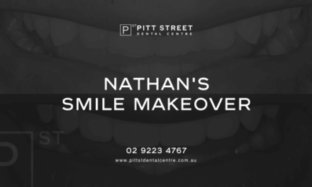 Nathan of Potts Point’s Veneers Makeover