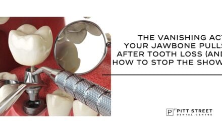 The Vanishing Act Your Jawbone Pulls After Tooth Loss (And How To Stop The Show)