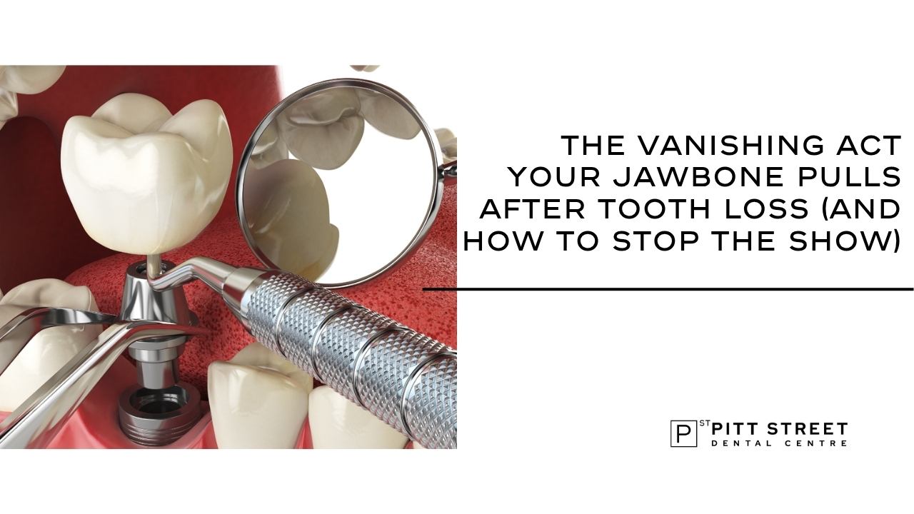 The Vanishing Act Your Jawbone Pulls After Tooth Loss (And How To Stop The Show)