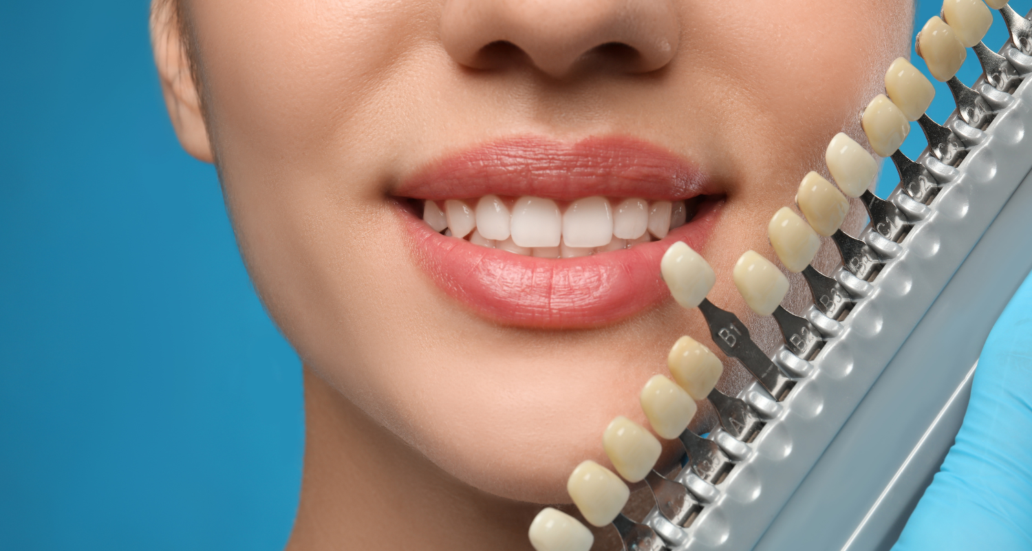 The Symphony of Smiles: Why Mixing Cosmetic Treatments Could Be Your Best Decision (Or Your Biggest Mistake)