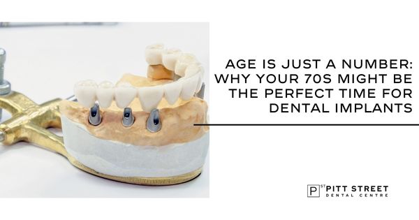 Age Is Just a Number: Why Your 70s Might Be the Perfect Time for Dental Implants