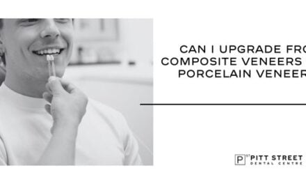 Can I Upgrade From Composite Veneers to Porcelain Veneers?
