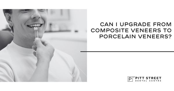 Can I Upgrade From Composite Veneers to Porcelain Veneers?