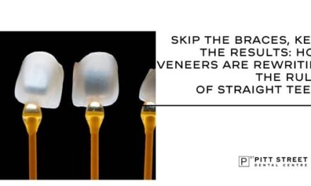 Skip the Braces, Keep the Results: How Veneers Are Rewriting the Rules of Straight Teeth