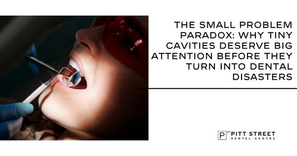 The Small Problem Paradox: Why Tiny Cavities Deserve Big Attention Before They Turn Into Dental Disasters