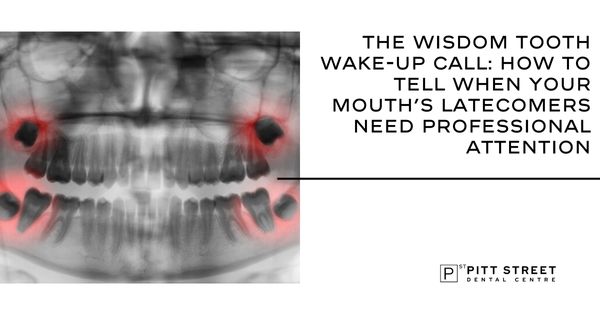The Wisdom Tooth Wake-Up Call: How to Tell When Your Mouth&rsquo;s Latecomers Need Professional Attention