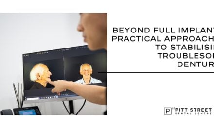 Beyond Full Implants: Practical Approaches to Stabilising Troublesome Dentures