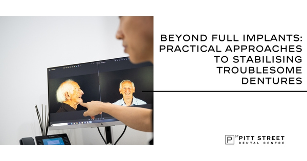 Beyond Full Implants: Practical Approaches to Stabilising Troublesome Dentures