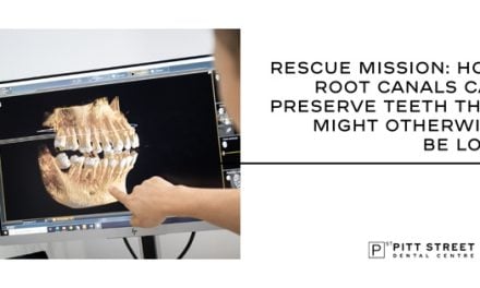 Rescue Mission: How Root Canals Can Preserve Teeth That Might Otherwise Be Lost