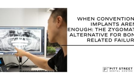 When Conventional Implants Aren&rsquo;t Enough: The Zygomatic Alternative for Bone-Related Failures