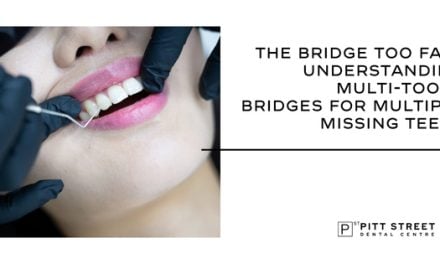 The Bridge Too Far? Understanding Multi-Tooth Bridges for Multiple Missing Teeth
