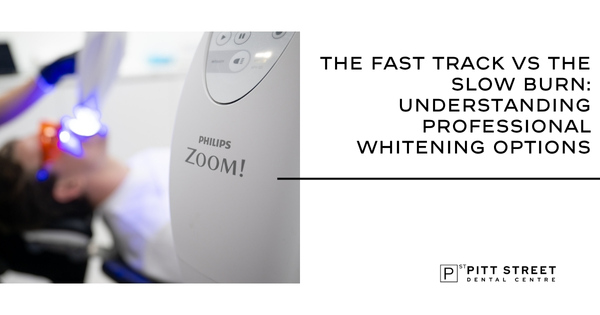 The Fast Track vs The Slow Burn: Understanding Professional Whitening Options