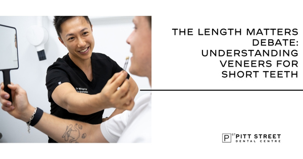 The Length Matters Debate: Understanding Veneers for Short Teeth