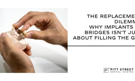 The Replacement Dilemma: Why Implants vs Bridges Isn&rsquo;t Just About Filling the Gap