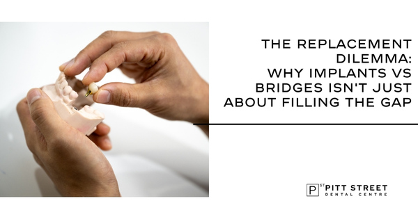 The Replacement Dilemma: Why Implants vs Bridges Isn&rsquo;t Just About Filling the Gap