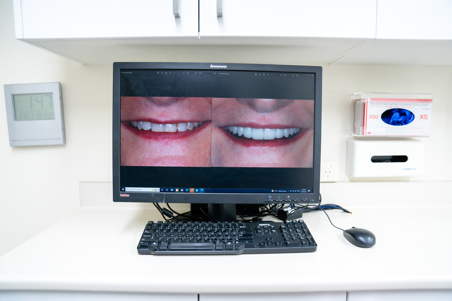 Affordable Cosmetic Dentist in Sydney: What &ldquo;Affordable&rdquo; Actually Means