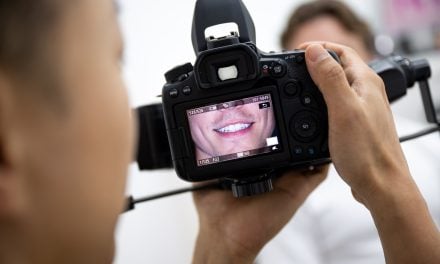 Dental Veneers in Sydney: What You Actually Need to Know