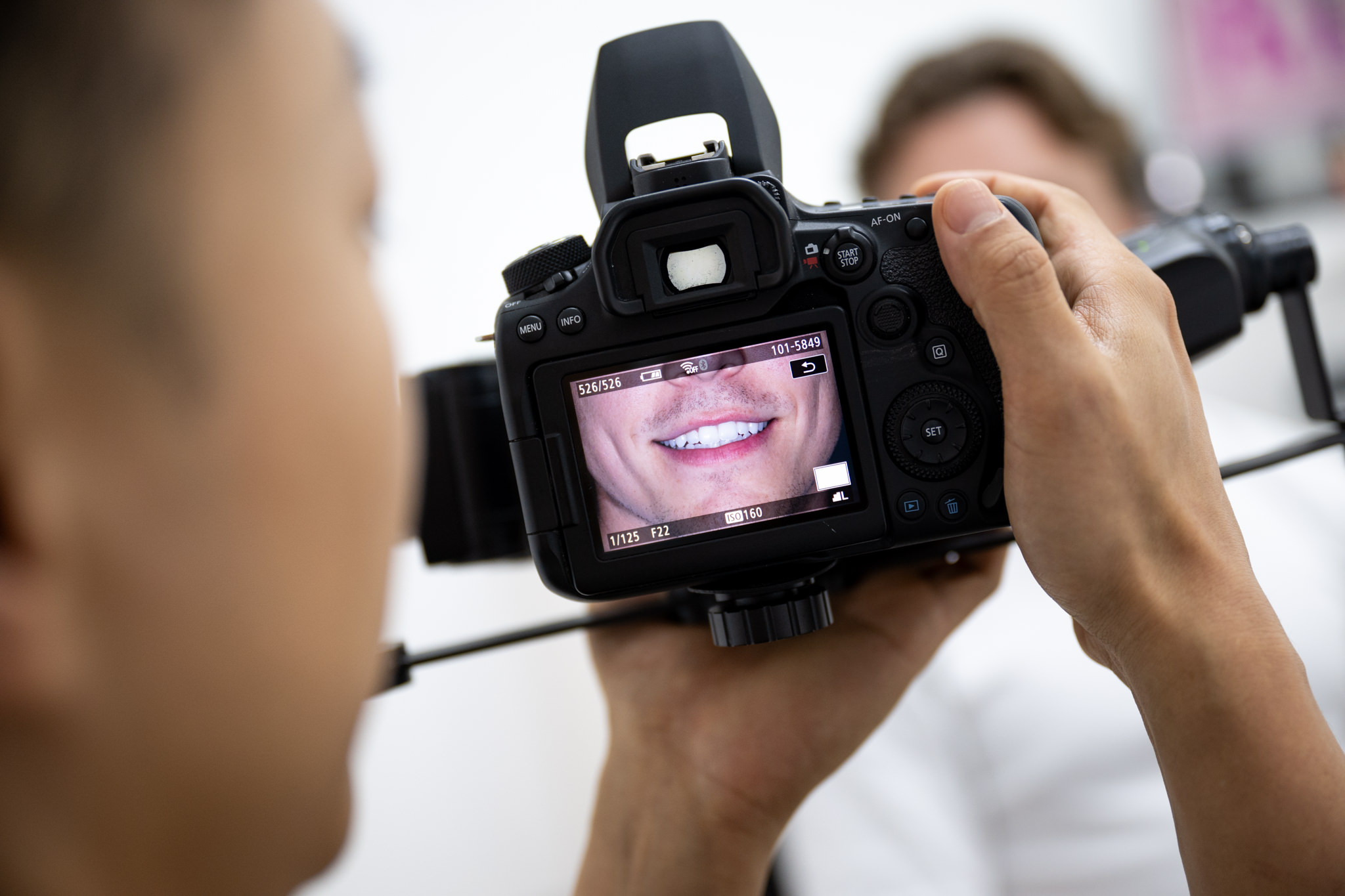 Dental Veneers in Sydney: What You Actually Need to Know
