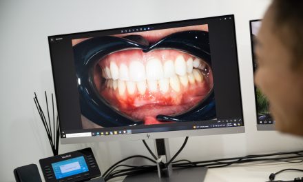 Teeth Whitening on Pitt Street: What to Expect in Sydney CBD