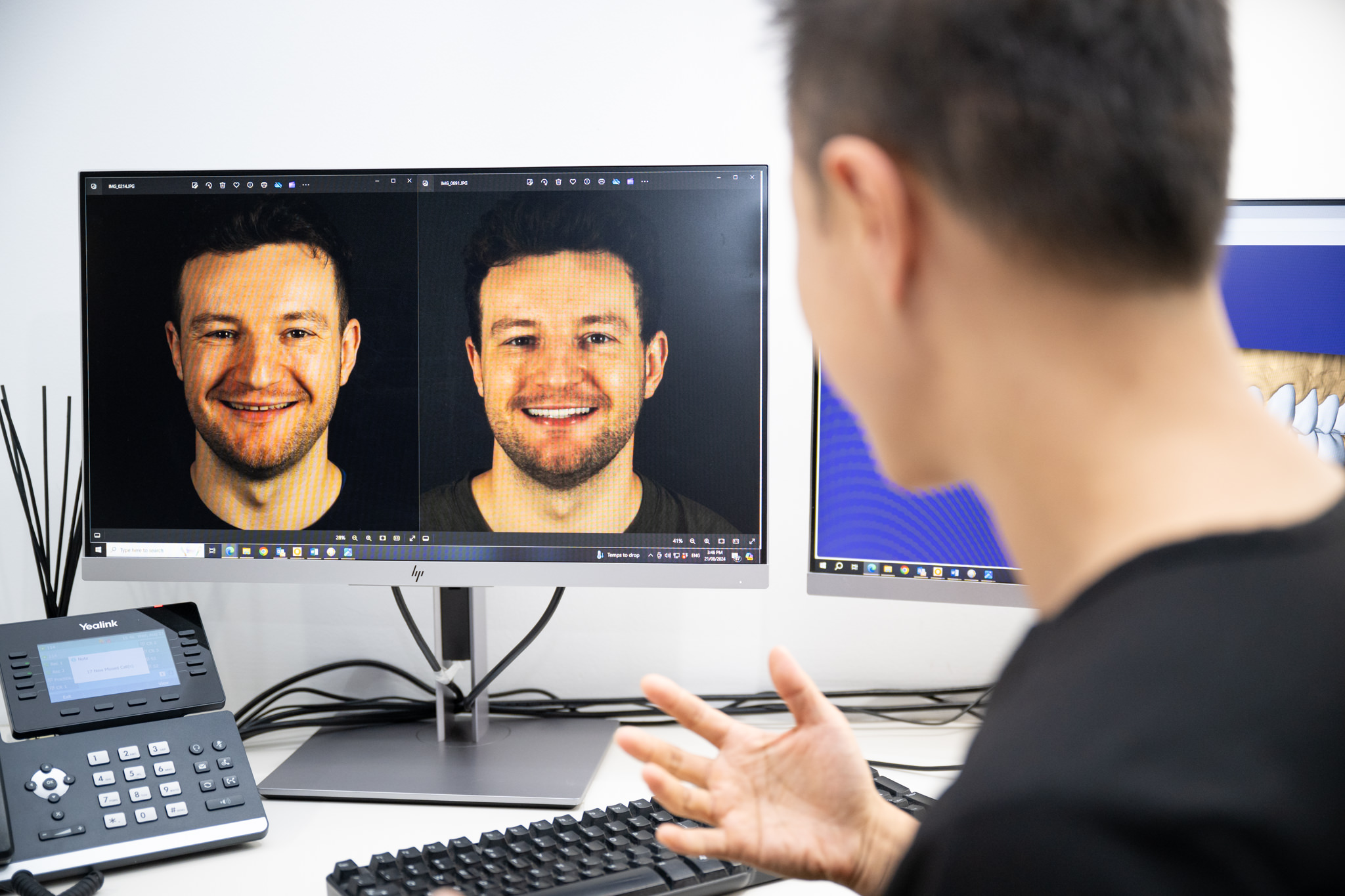 What Makes a Dental Clinic Top-Rated for Smile Design in Sydney?
