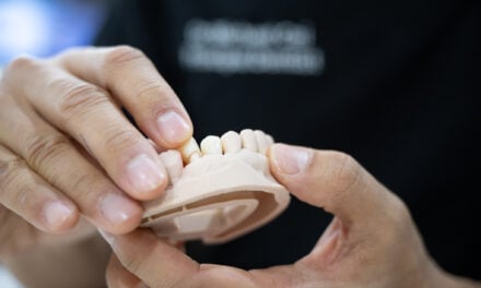 Can I Get Same Day Dental Crowns in Sydney 2000? Here Is the Honest Answer