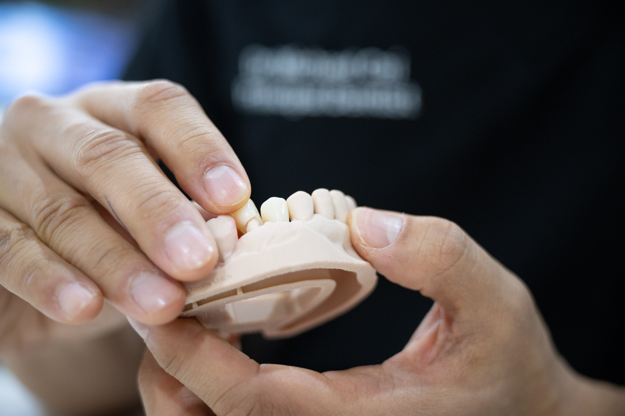 Can I Get Same Day Dental Crowns in Sydney 2000? Here Is the Honest Answer