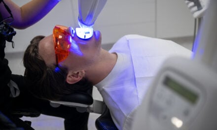 How Much Does Teeth Whitening Cost in The Rocks, Sydney? Here Is What Matters