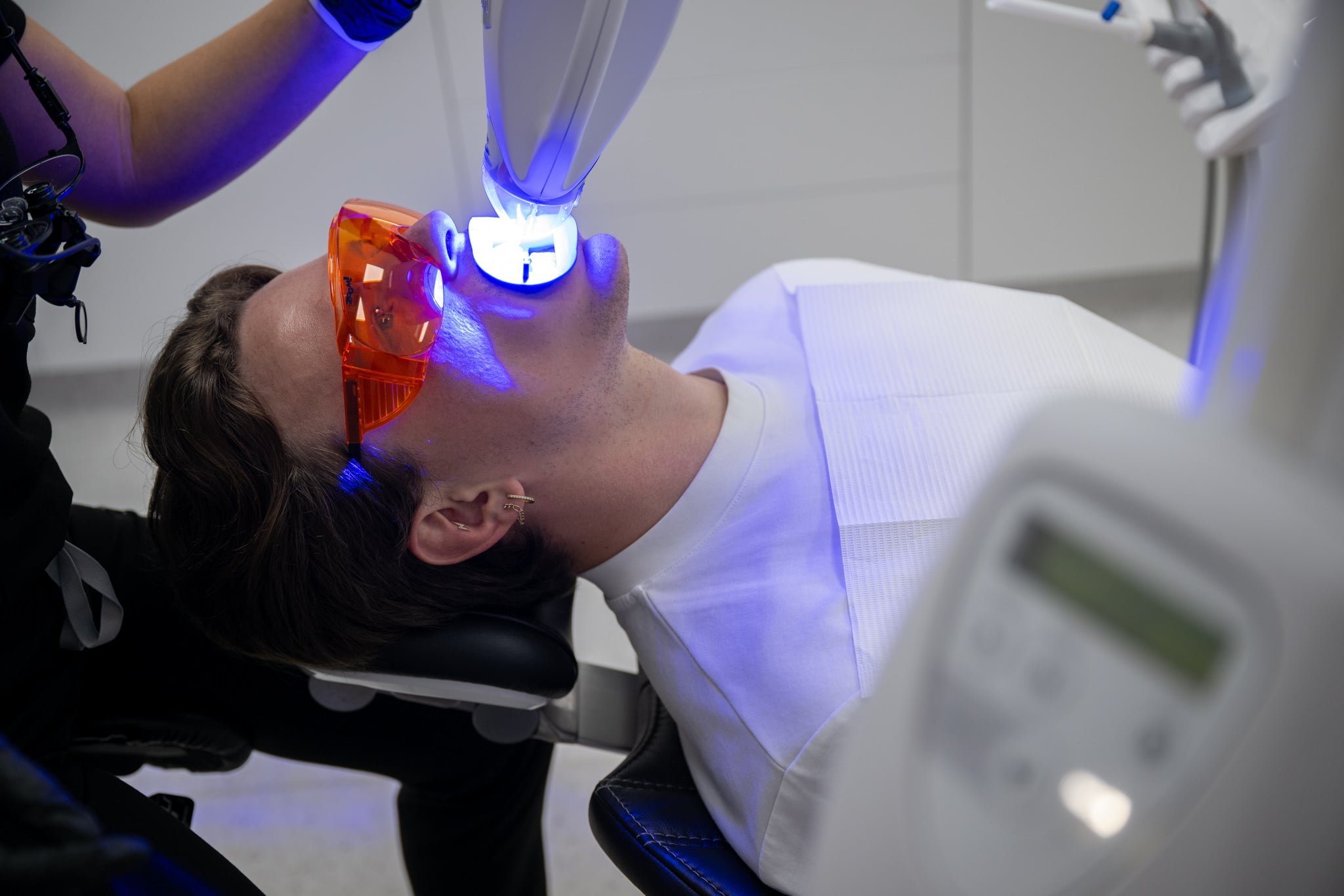 How Much Does Teeth Whitening Cost in The Rocks, Sydney? Here Is What Matters