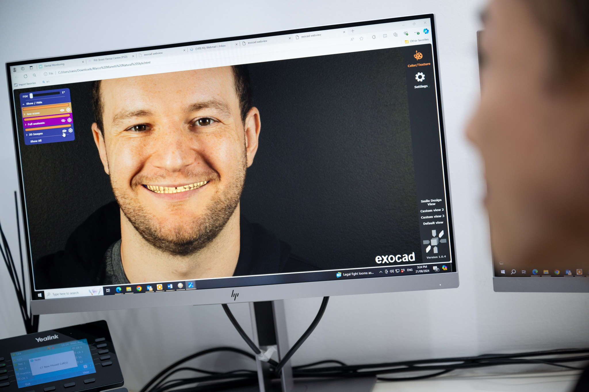 What Makes a Dental Clinic Top-Rated for Smile Design in Sydney?