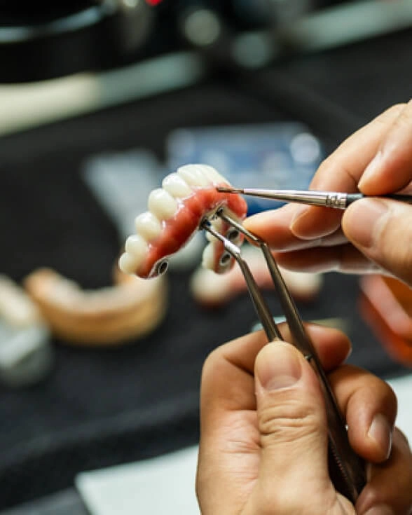 All-on-4 is a full-arch dental implant technique
