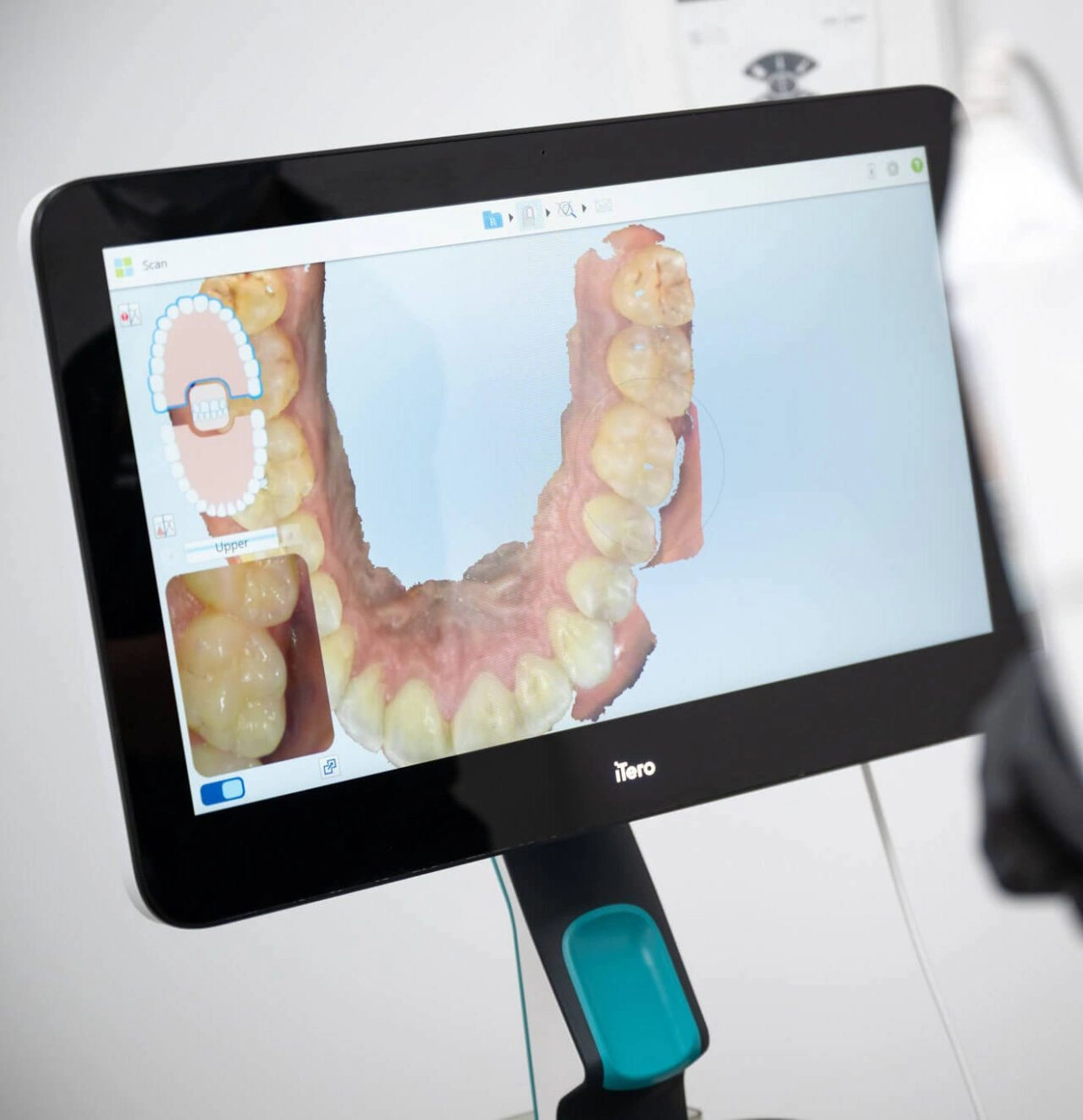 CEREC Candidates At Sydney In Pitt Street Dental Centre 1280x1324