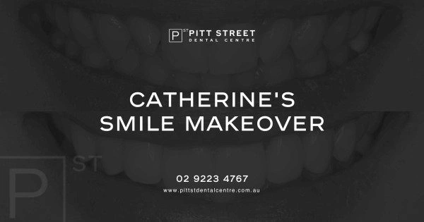 Catherine of Sydneys Porcelain Veneers Makeover 1