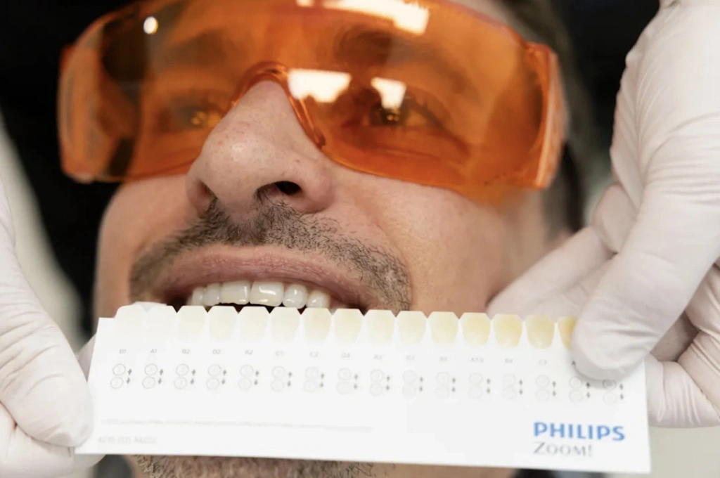 Dental hygienist Charmaine Mahel holds a "shade guide" agains Carre's teeth