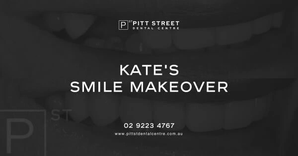 Kate of Balmains Dental Implant Makeover in Pitt Street Dental Centre