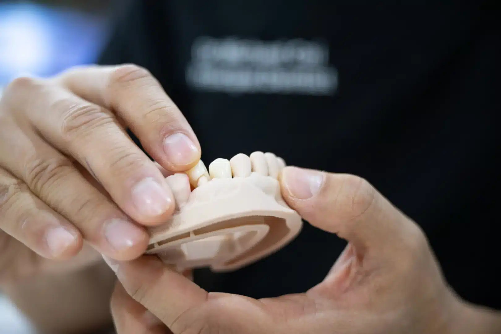 emergency tooth crown replacement Sydney