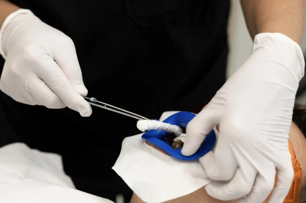 gauze is removed from Jean Carre’s mouth when the whitening is finished. JANIE BARRETT
